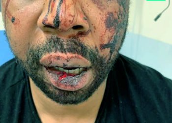 Violences policières : Un homme d’origine martiniquaise violemment tabassé à Paris