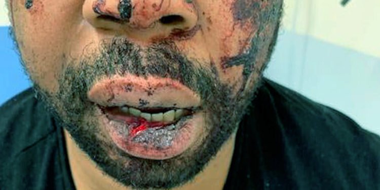 Violences policières : Un homme d’origine martiniquaise violemment tabassé à Paris