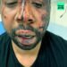 Violences policières : Un homme d’origine martiniquaise violemment tabassé à Paris