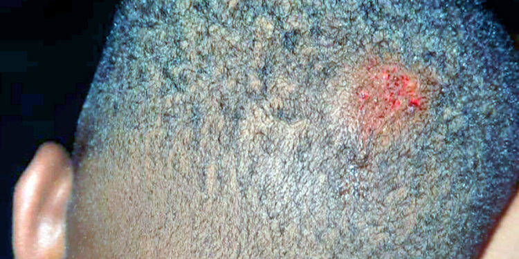 Inconscience : Un enfant de trois ans chute d’un scooter